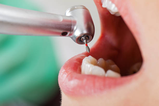 Best Emergency Dental Surgery in Sellersburg, IN